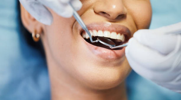 Best Emergency Wisdom Tooth Extraction in Clarkston, WA